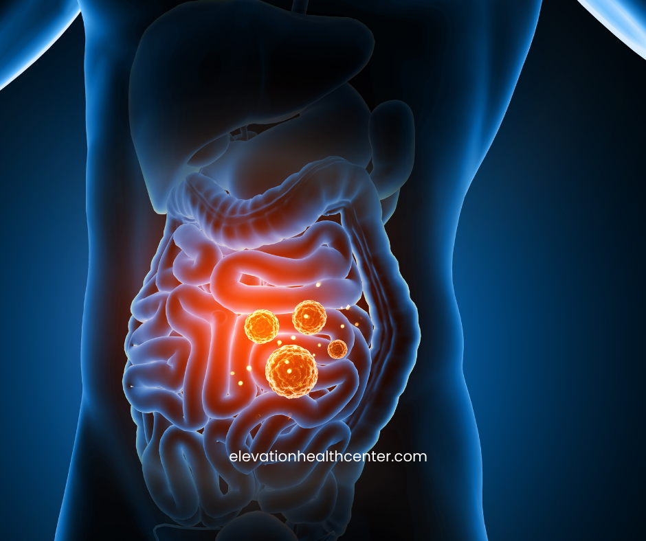ai image of intestine parasite detox
