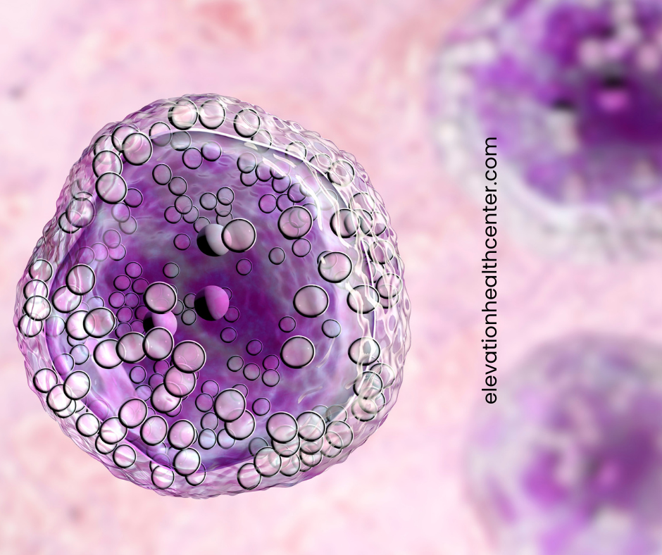 autoimmune disease